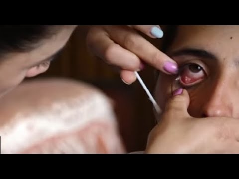 Woman cries 'crystal tears'| CCTV English