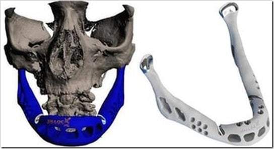 mandibula-3d