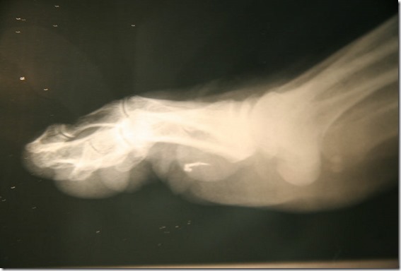 implantes-alienigenas-3