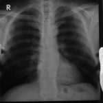 Imagem relacionada a Cientistas cultivam pulmões humanos em um laboratório