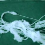 Imagem relacionada a Fenômeno do Cabelo de Anjo e a conexão com OVNIs