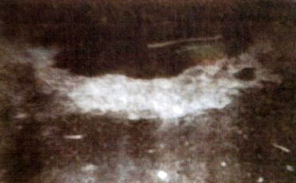 Imagem relacionada a Caso do anel deixado por OVNI em Delphos